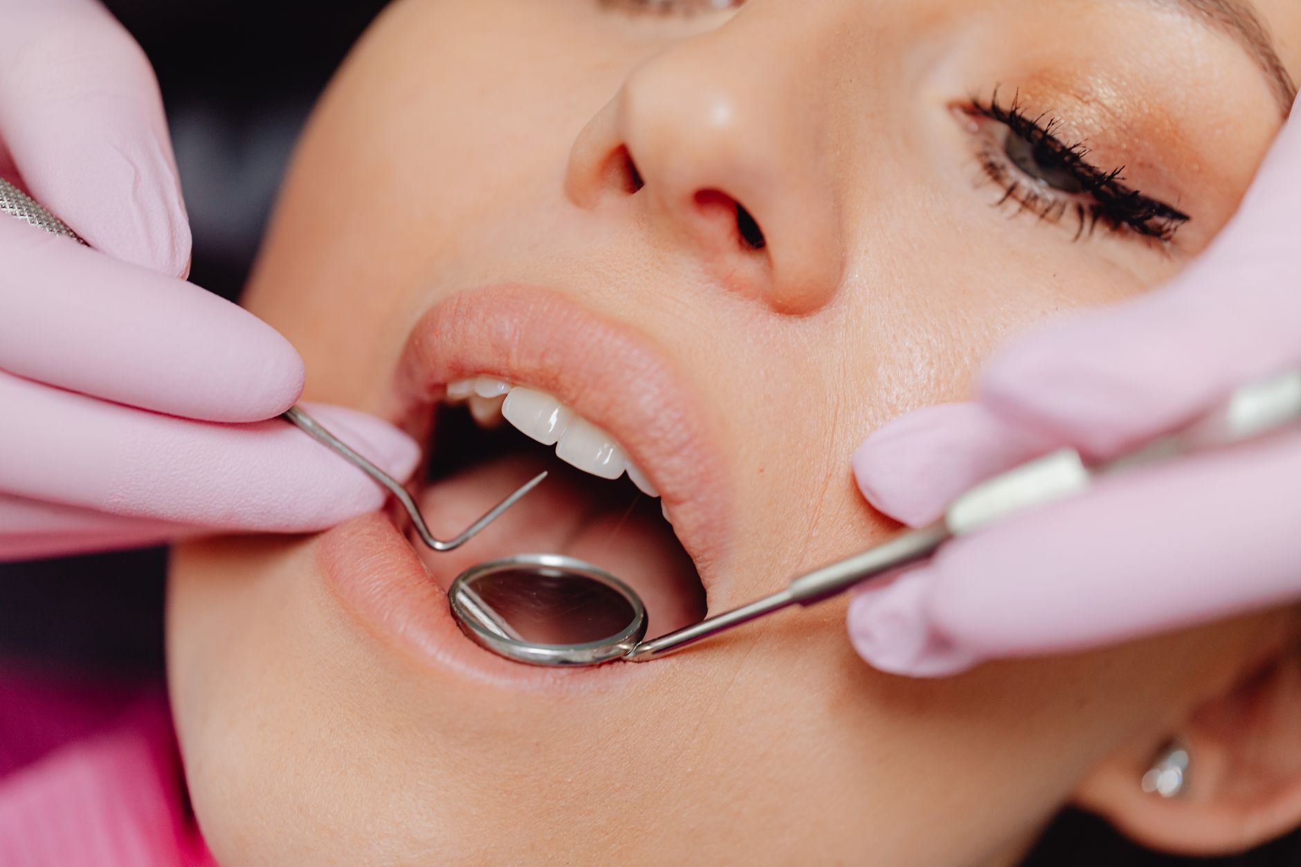 Close-up of a woman's dental checkup with dental instruments in view; stock image used to illustrate a routine examination.