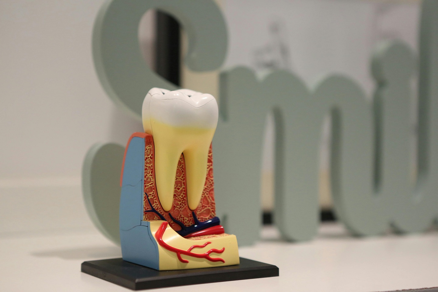 A colorful cross-section model of a tooth showing roots and pulp canals; stock model used to explain root canal treatment.